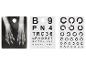 Une radiographie de la main et une carte d'examen de la vue avec des lettres et des cercles.