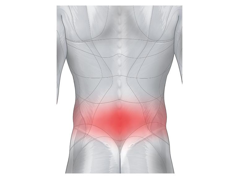 Douleur lombaire illustrée sur une image anatomique.